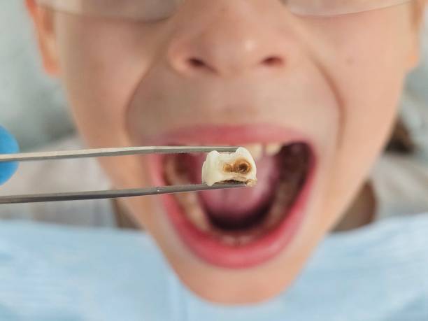 Best Emergency Broken Tooth Repair in Sunray, TX