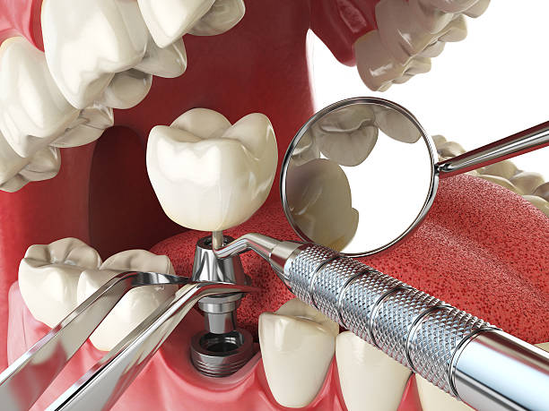 Best Emergency Broken Tooth Repair in Sunray, TX